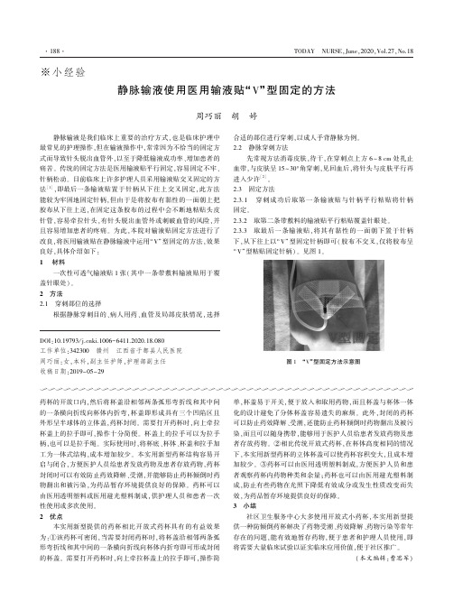 静脉输液使用医用输液贴“V”型固定的方法