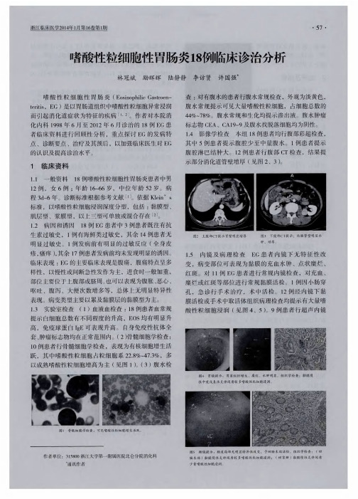 嗜酸性粒细胞性胃肠炎18例临床诊治分析