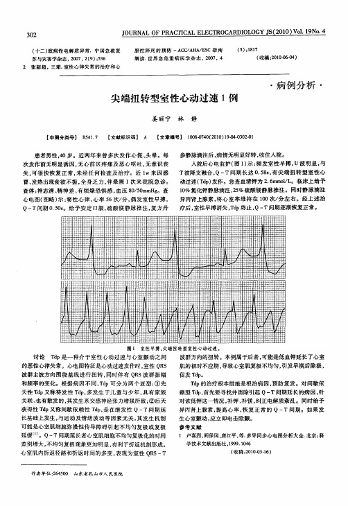 尖端扭转型室性心动过速1例