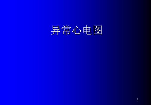 诊断学：异常心电图