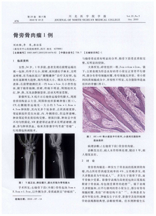 骨旁骨肉瘤1例