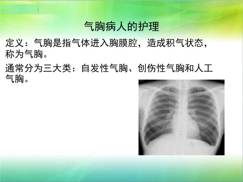 医院护理规培学习：呼吸内科小讲课A2组