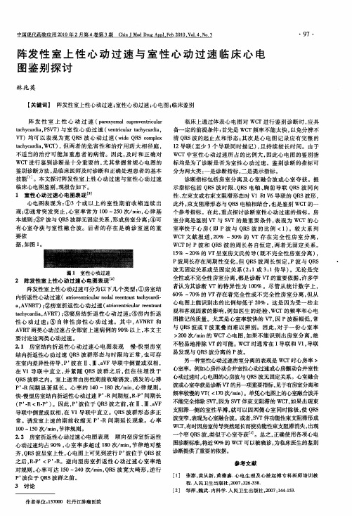 阵发性室上性心动过速与室性心动过速临床心电图鉴别探讨