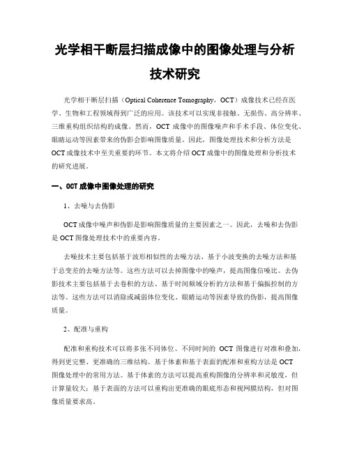 光学相干断层扫描成像中的图像处理与分析技术研究