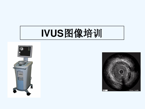 血管内超声ilab 图像培训 PPT