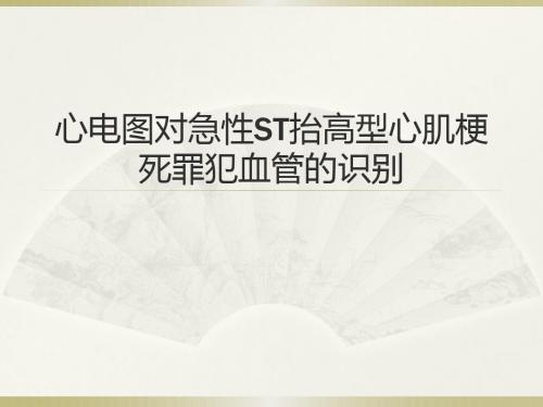 体表心电图对急性STEMI罪犯血管的识别