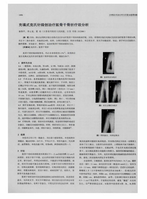 充填式克氏针微创治疗肱骨干骨折疗效分析