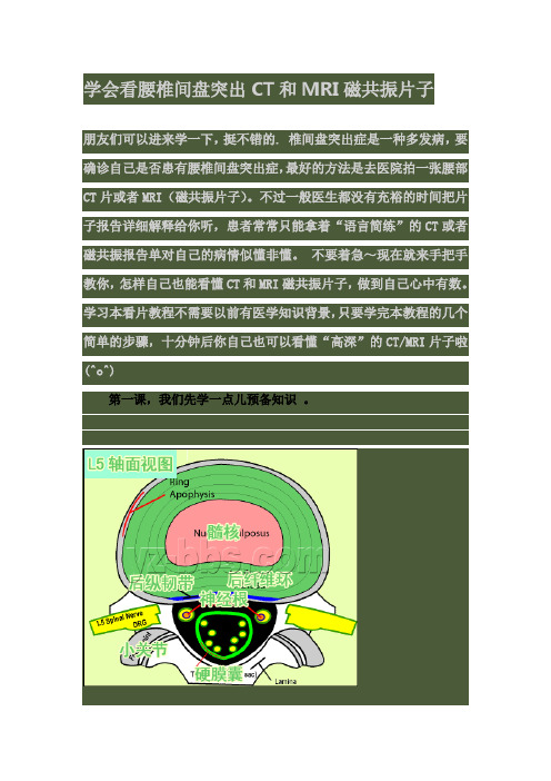 学会看腰椎间盘突出CT和MRI磁共振片子