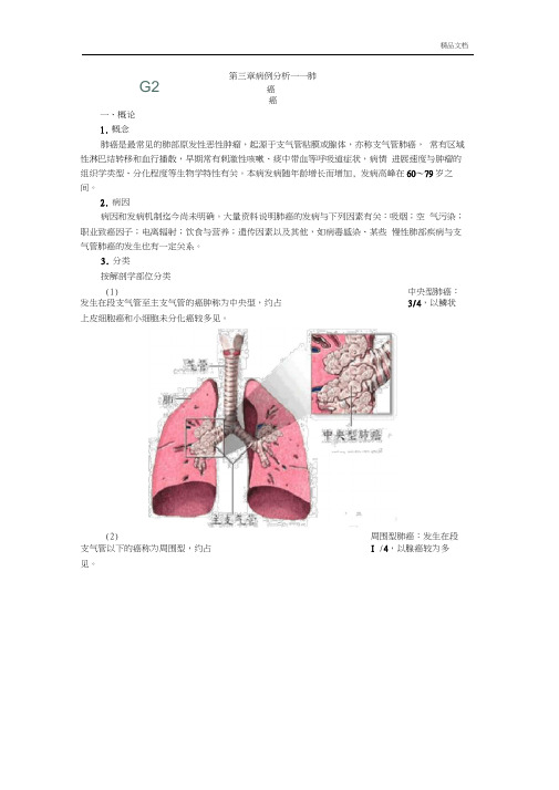 病例分析——肺癌