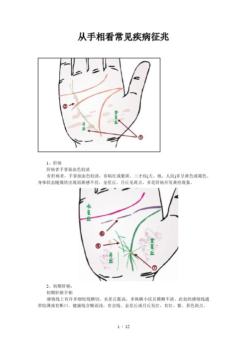 从手相看常见疾病征兆参考模板