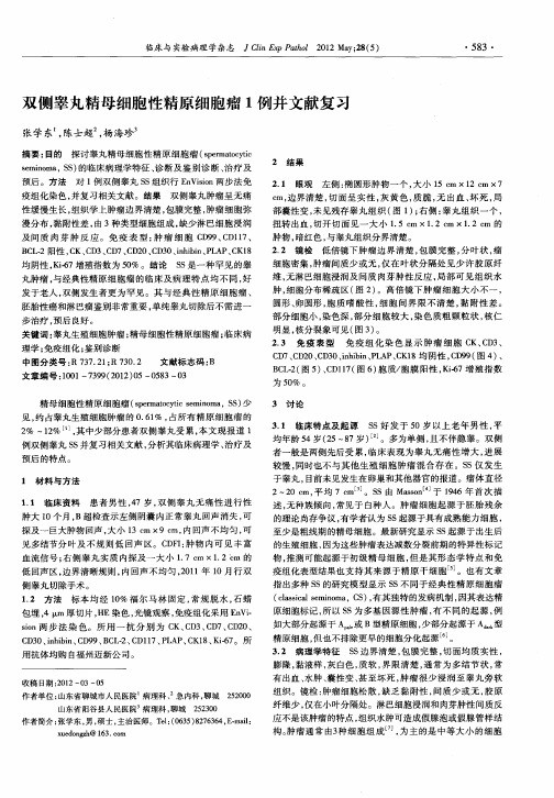 双侧睾丸精母细胞性精原细胞瘤1例并文献复习