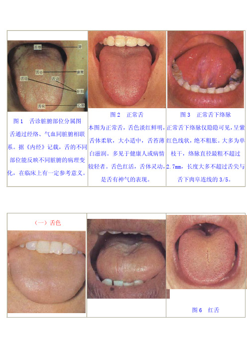 舌诊图集附详解