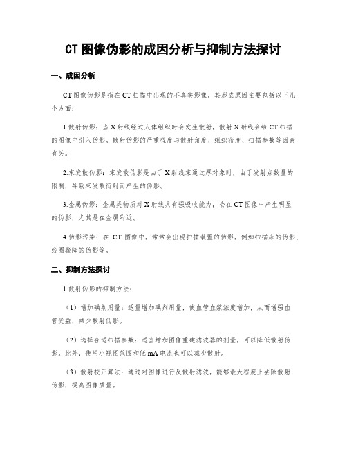 CT图像伪影的成因分析与抑制方法探讨