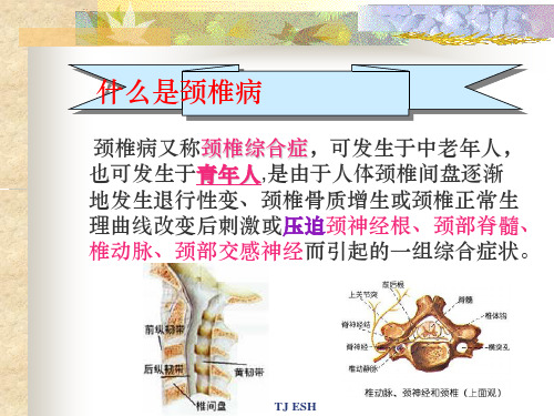 [颈椎病预防保健操](4)