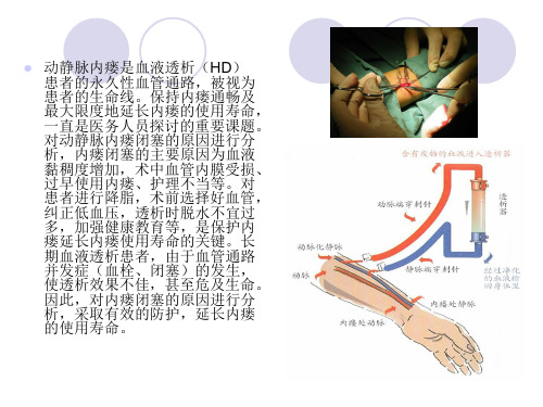 血液透析患者动静脉内瘘闭塞的原因及防护ppt课件