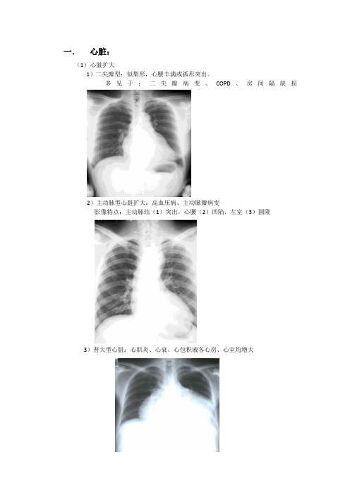 影像学重点