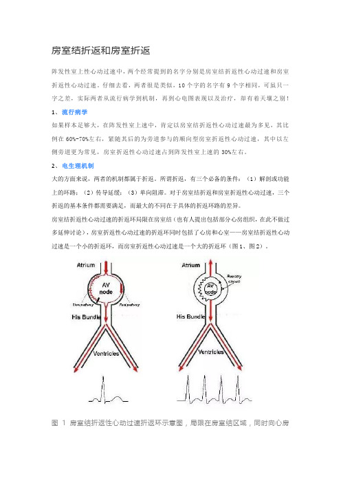 房室结折返和房室折返鉴别