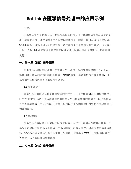 Matlab在医学信号处理中的应用示例