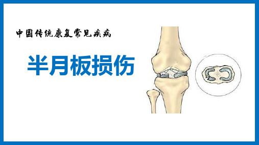 半月板损伤传统康复