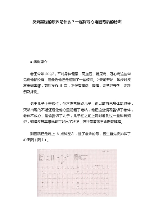 反复黑朦的原因是什么？一起探寻心电图背后的秘密