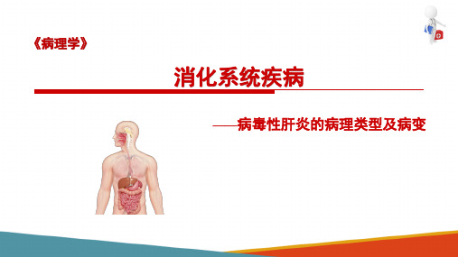 病毒性肝炎—病毒性肝炎类型(病理学课件)