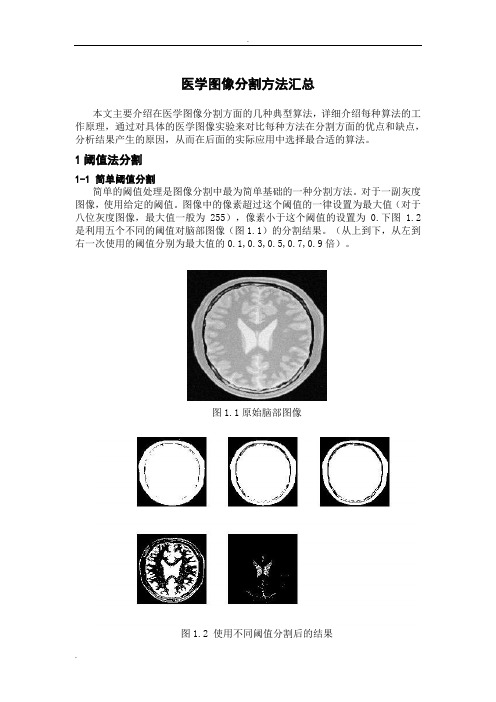 医学图像分割方法汇总