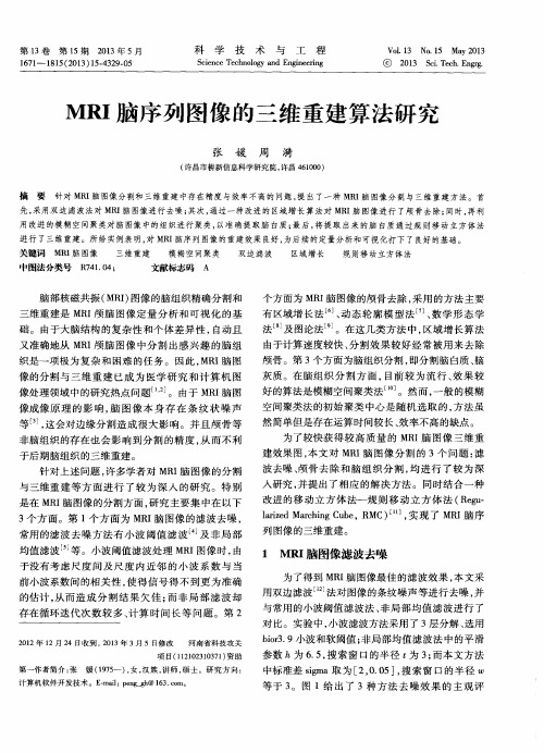 MRI脑序列图像的三维重建算法研究