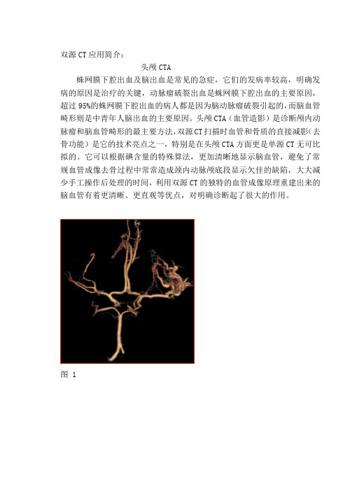 双源CT应用简介