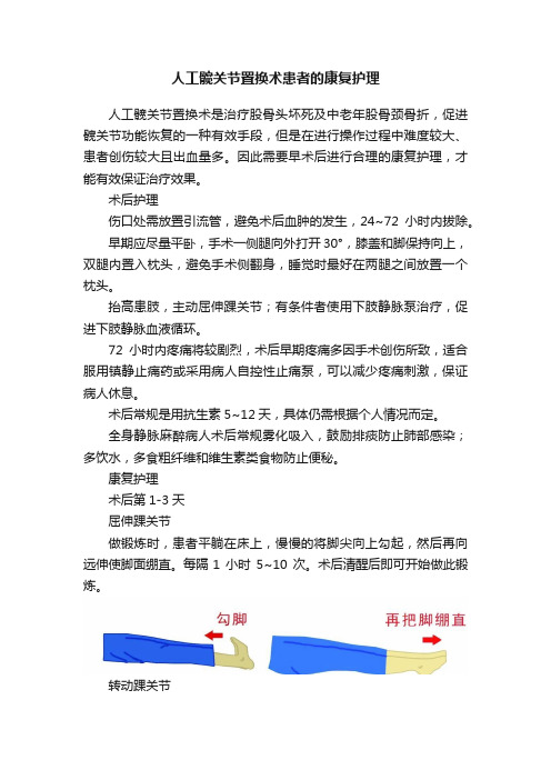 人工髋关节置换术患者的康复护理