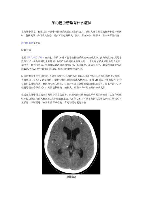 颅内蠕虫感染有什么症状