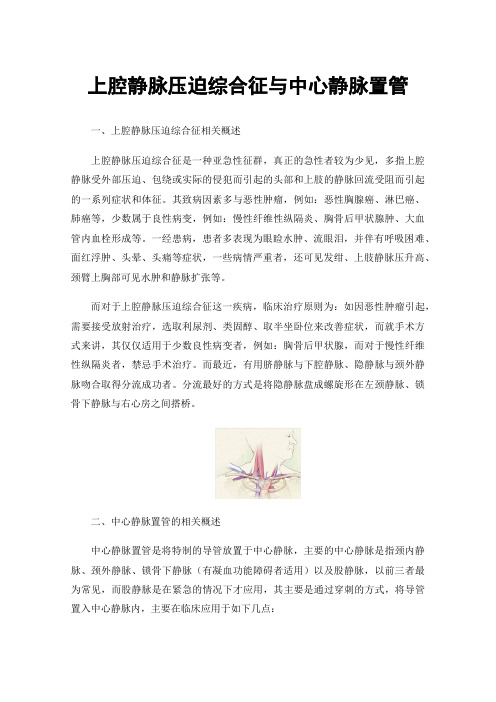 上腔静脉压迫综合征与中心静脉置管