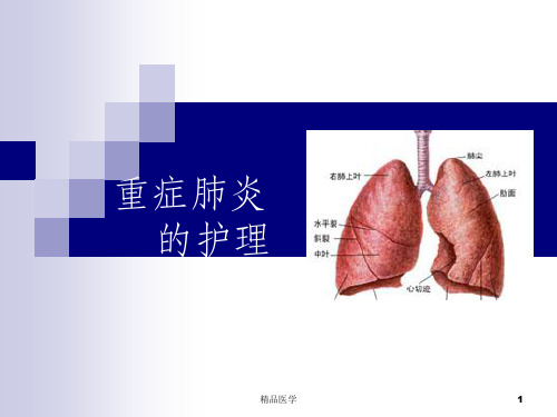 《重症肺炎的护理》PPT课件