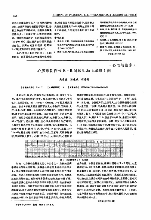 心房颤动伴长R-R间歇9.5s无晕厥1例