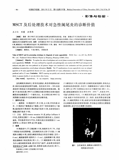 MSCT及后处理技术对急性阑尾炎的诊断价值