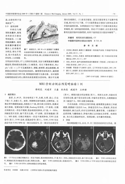 MRI诊断右侧后颅窝畸胎瘤1例