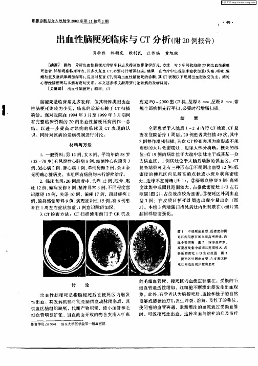 出血性脑梗死临床与CT分析(附20例报告)