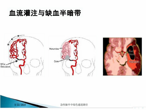 急性脑卒中绿色通道路径培训ppt课件