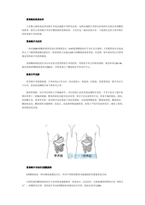 胃旁路的效果如何