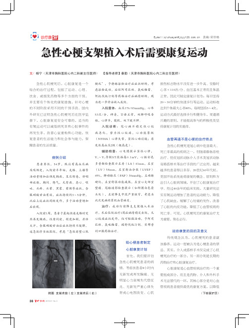 急性心梗支架植入术后需要康复运动