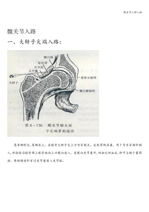 髋关节三种入路