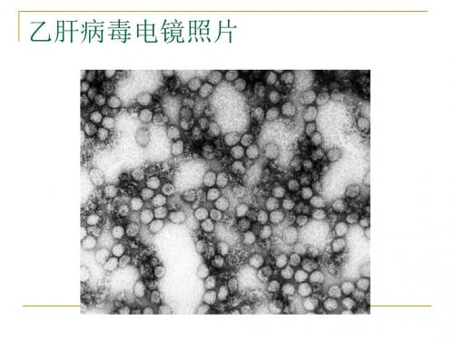 最新乙型肝炎病毒检验结果判断-精选PPT文档