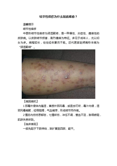 结节性痒疹为什么如此难愈？