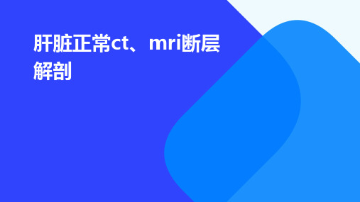 肝脏正常ct、mri断层解剖