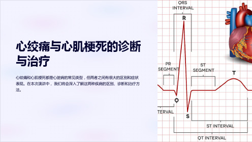 心绞痛与心肌梗死的诊断与治疗