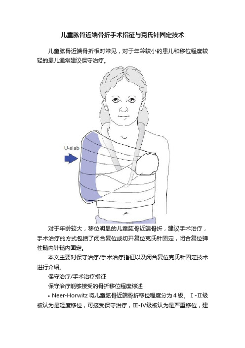 儿童肱骨近端骨折手术指征与克氏针固定技术