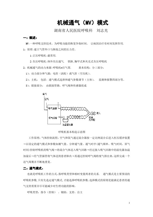 机械通气模式