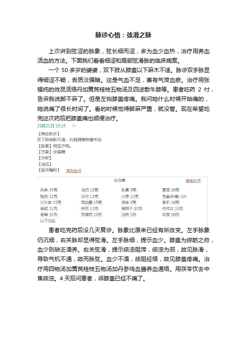 脉诊心悟：弦滑之脉