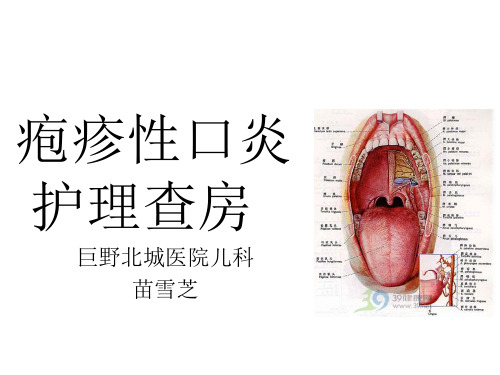 疱疹性口炎护理查房17540