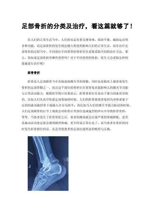 足部骨折的分类及治疗，看这篇就够了！