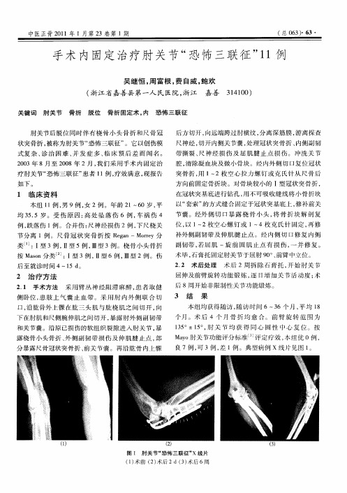 手术内固定治疗肘关节“恐怖三联征”11例